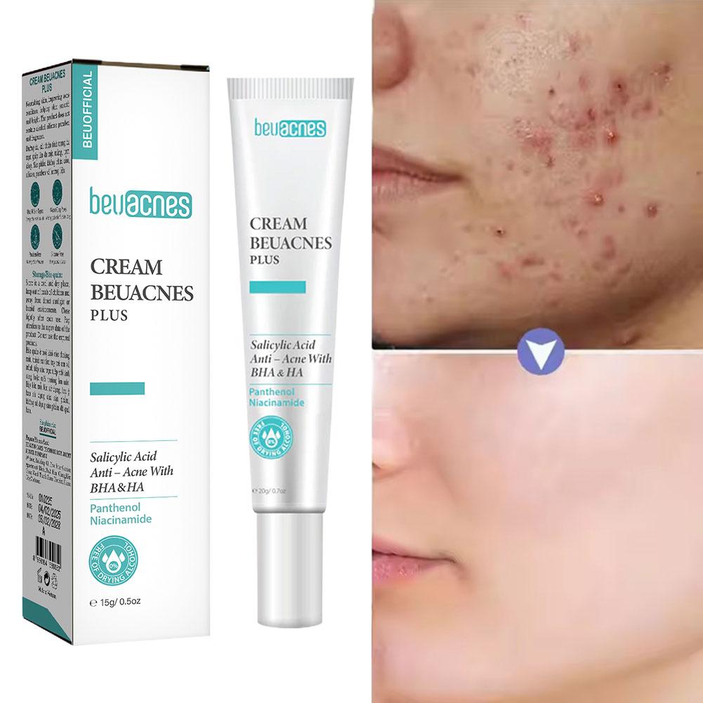 Skincare Niacinamide - Novo 20g niacinamida acne gel anti-acne