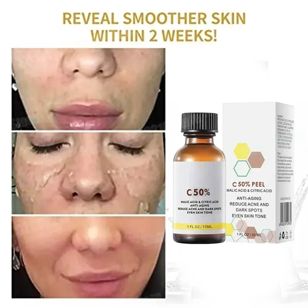 Skincare Salicylic Acid - Ácido salicílico rosto casca facial neutralizador