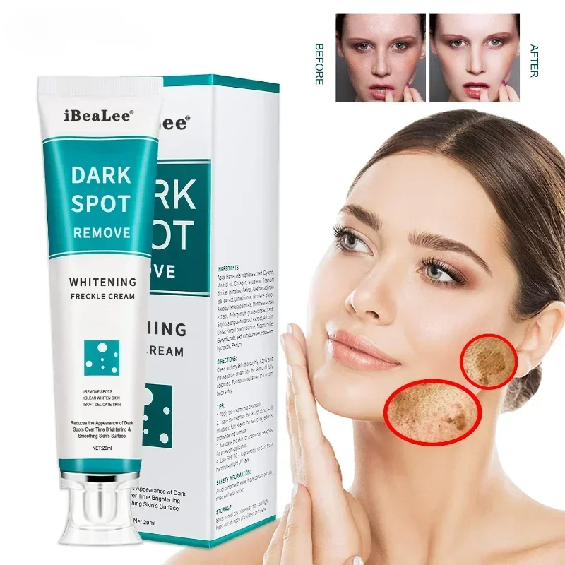 Skincare Glowing - Clareamento creme de sardas remover manchas