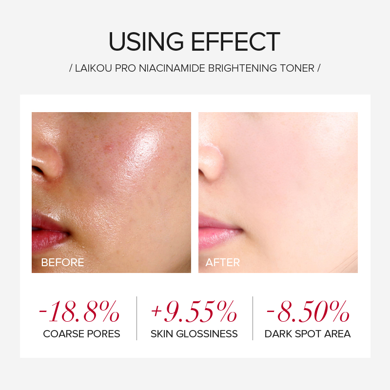 Conjunto de Cuidados com a Pel - Skincare Niacinamide avaliação e preço