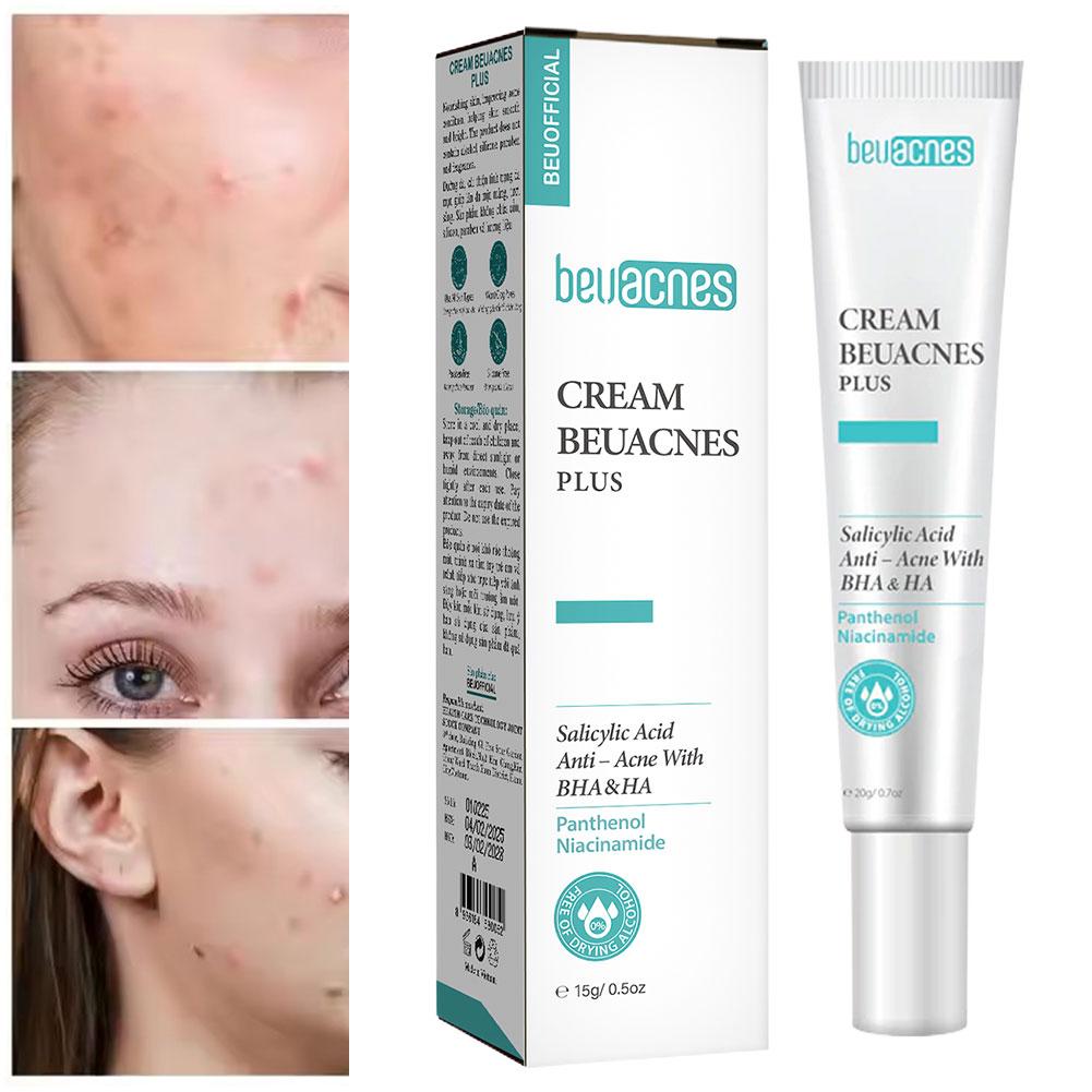 Novo 20g niacinamida acne gel  - Skincare Niacinamide avaliação e preço