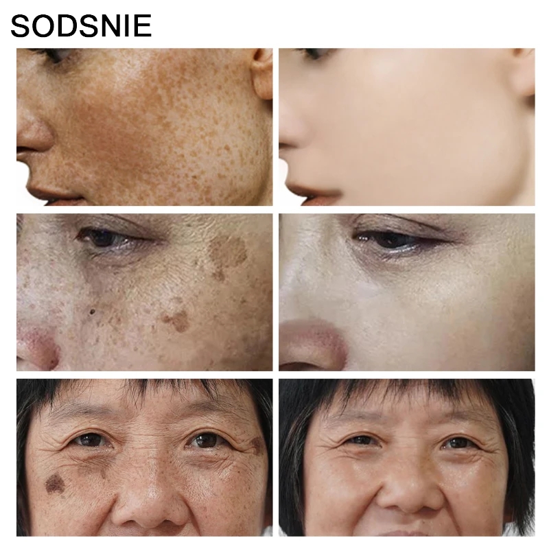 Removedor de manchas escuras v - Skincare Niacinamide avaliação e preço