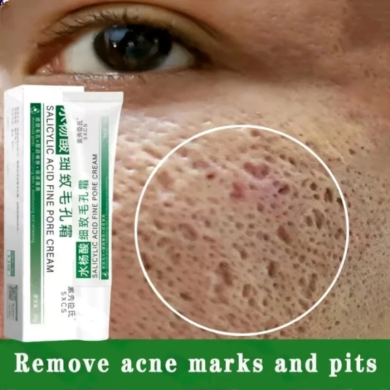 Ácido salicílico poros limpeza - Skincare Salicylic Acid avaliação e preço