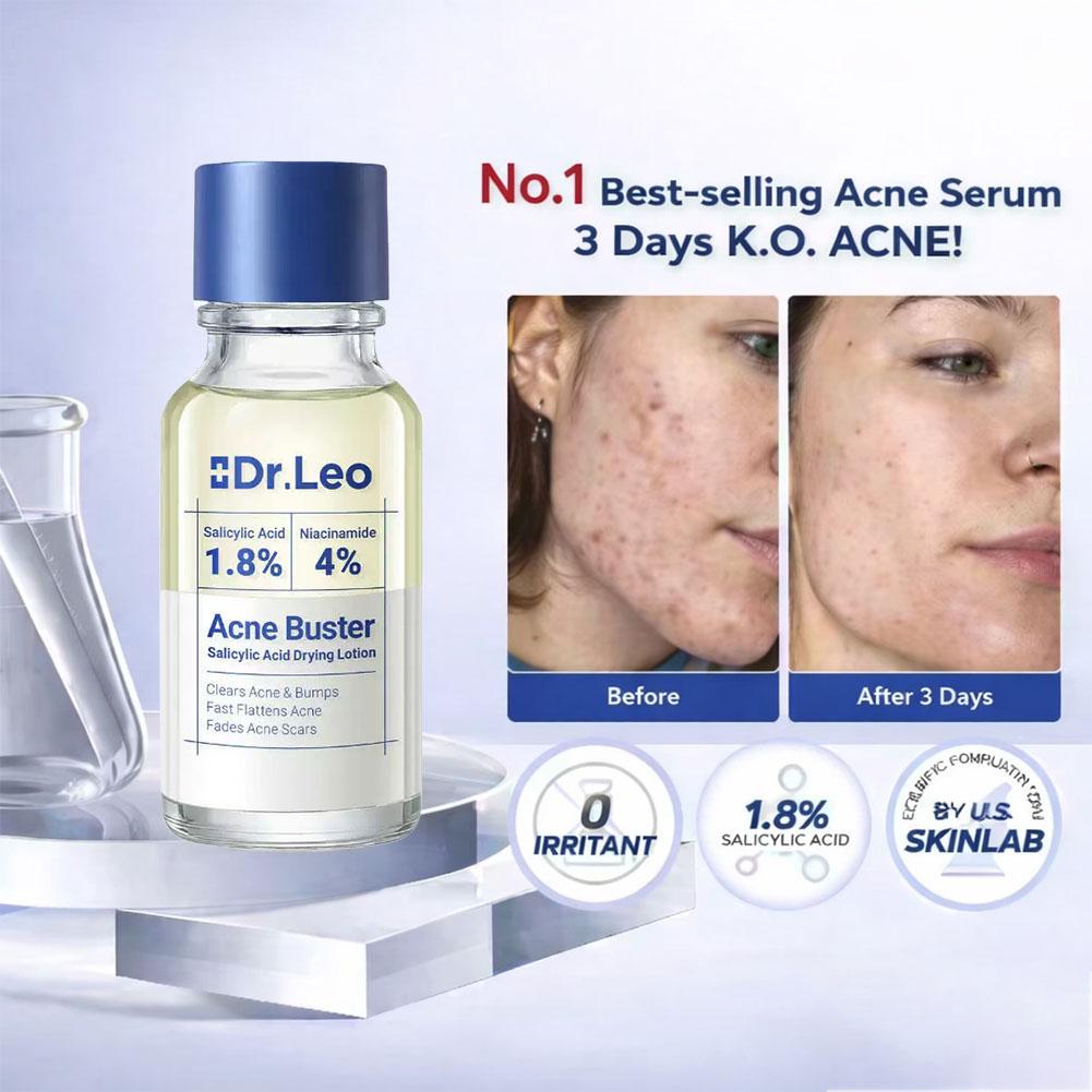 Loção de Tratamento com Ácido  - Skincare Salicylic Acid avaliação e preço