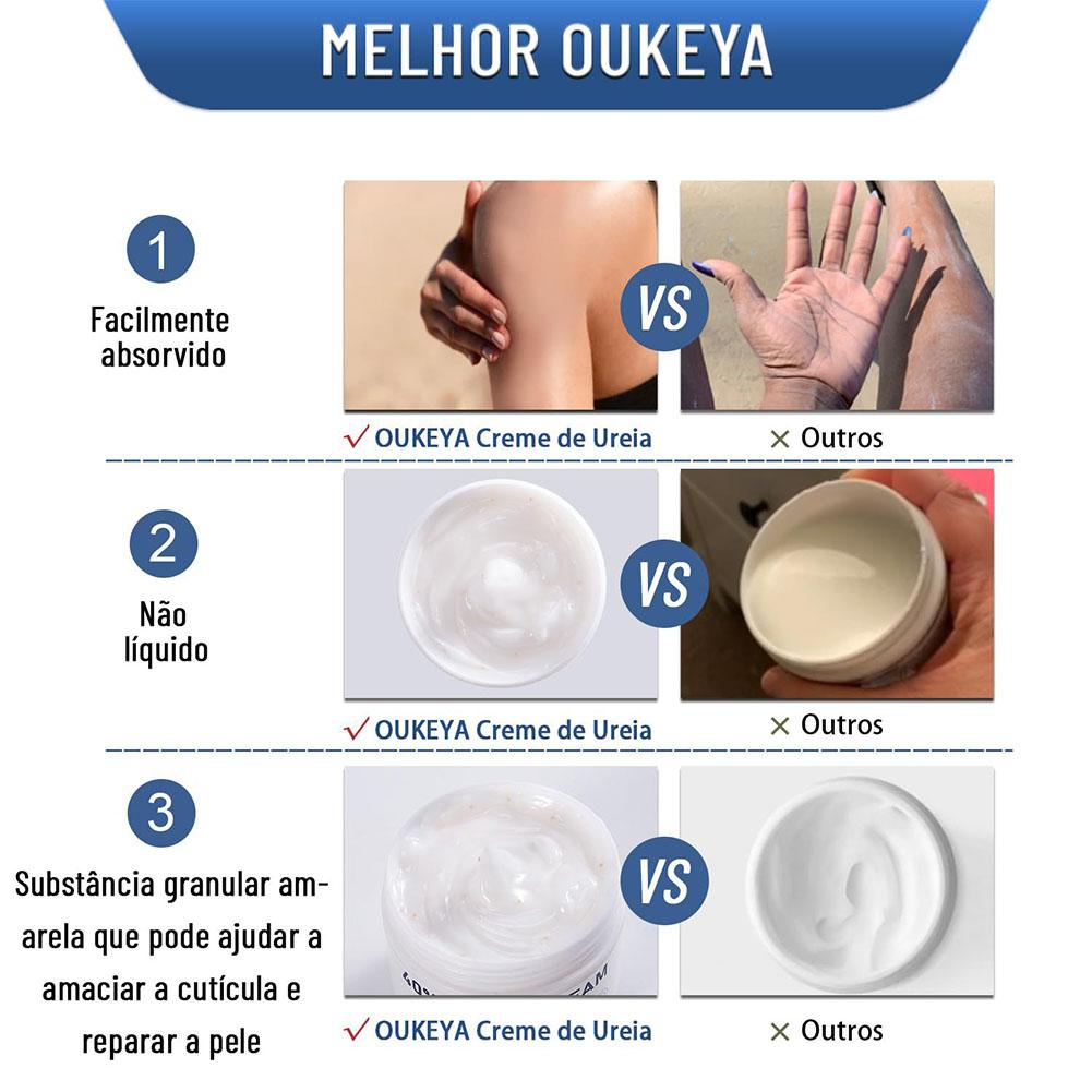 Creme de Ureia 40% Hidratante  - Urea Foot Cream avaliação e preço