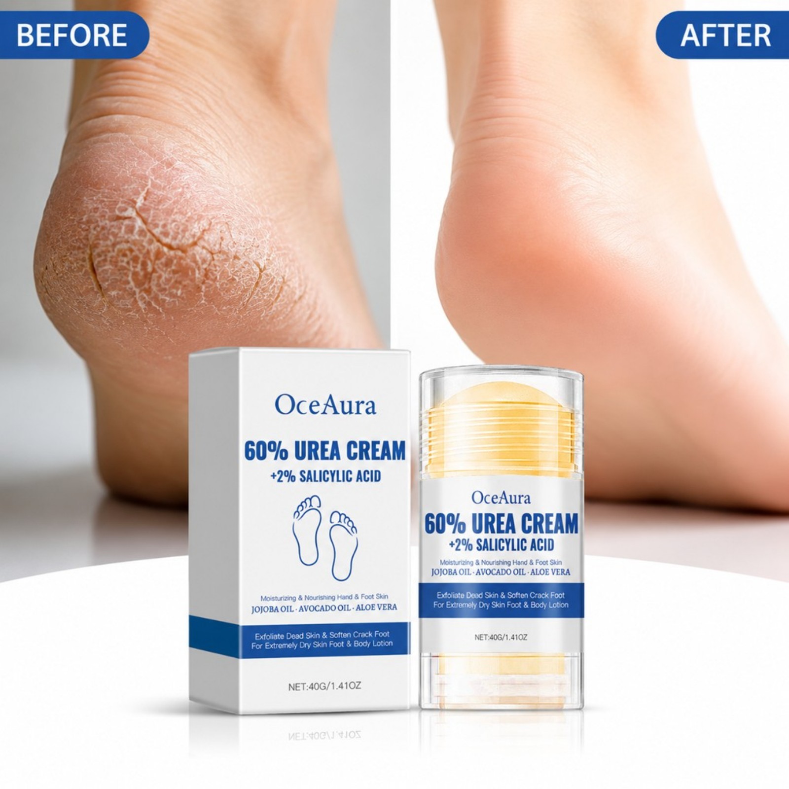 Creme Hidratante e Esfoliante  - Urea Foot Cream avaliação e preço