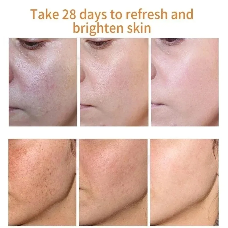 Desaparece sardas manchas escu - Skincare Niacinamide avaliação e preço