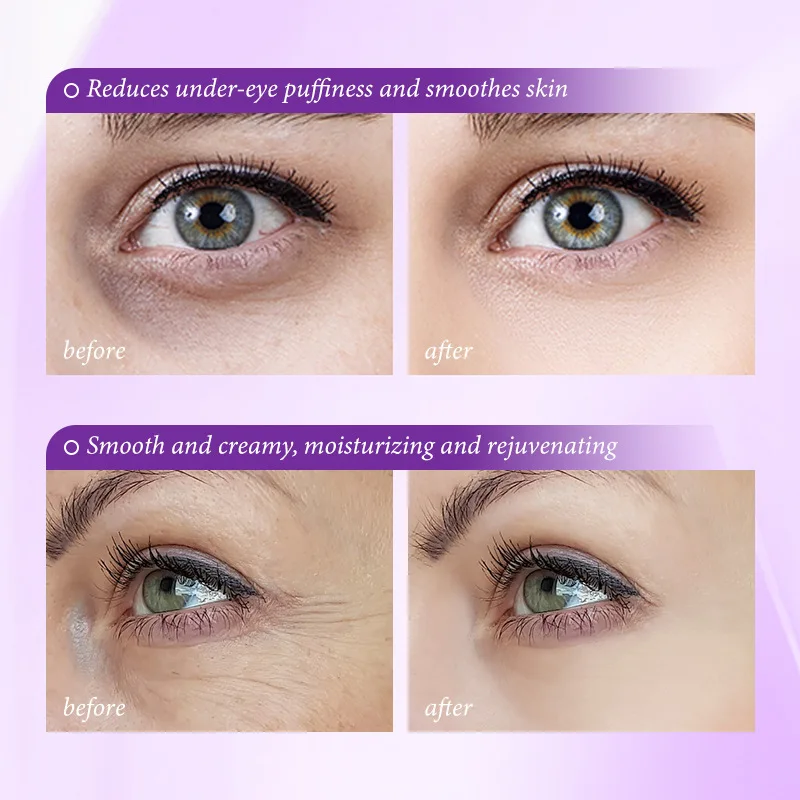Creme Instantâneo para Remoção - Skincare D'Alba avaliação e preço
