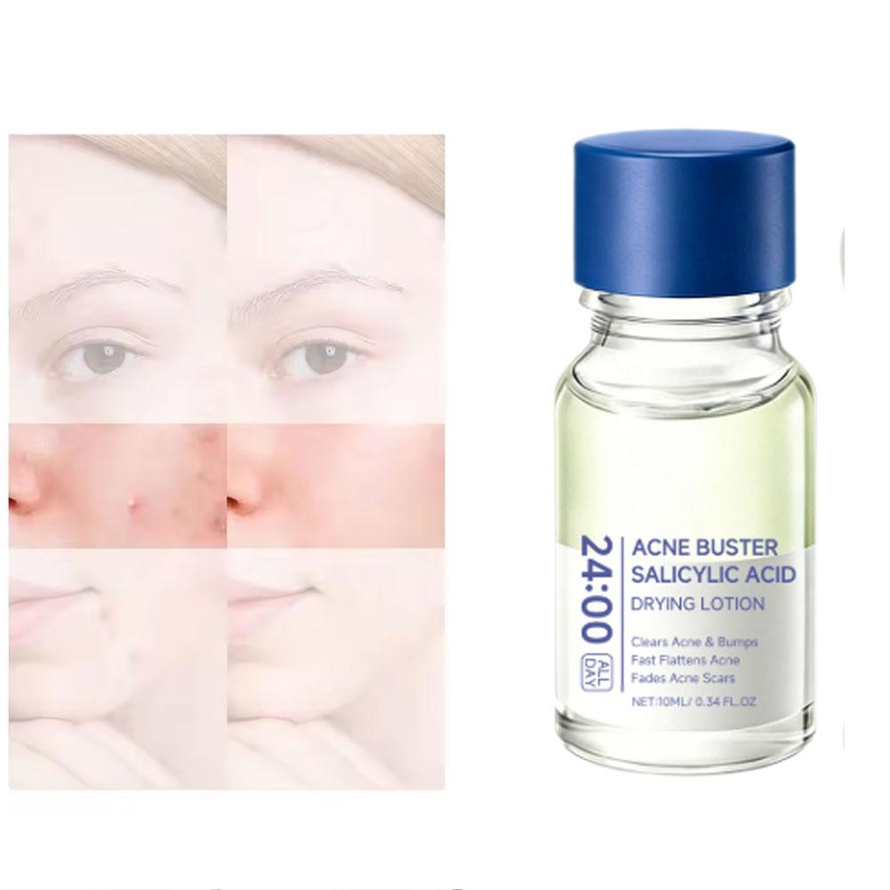 Loção de Tratamento com Ácido  - Skincare Salicylic Acid avaliação e preço