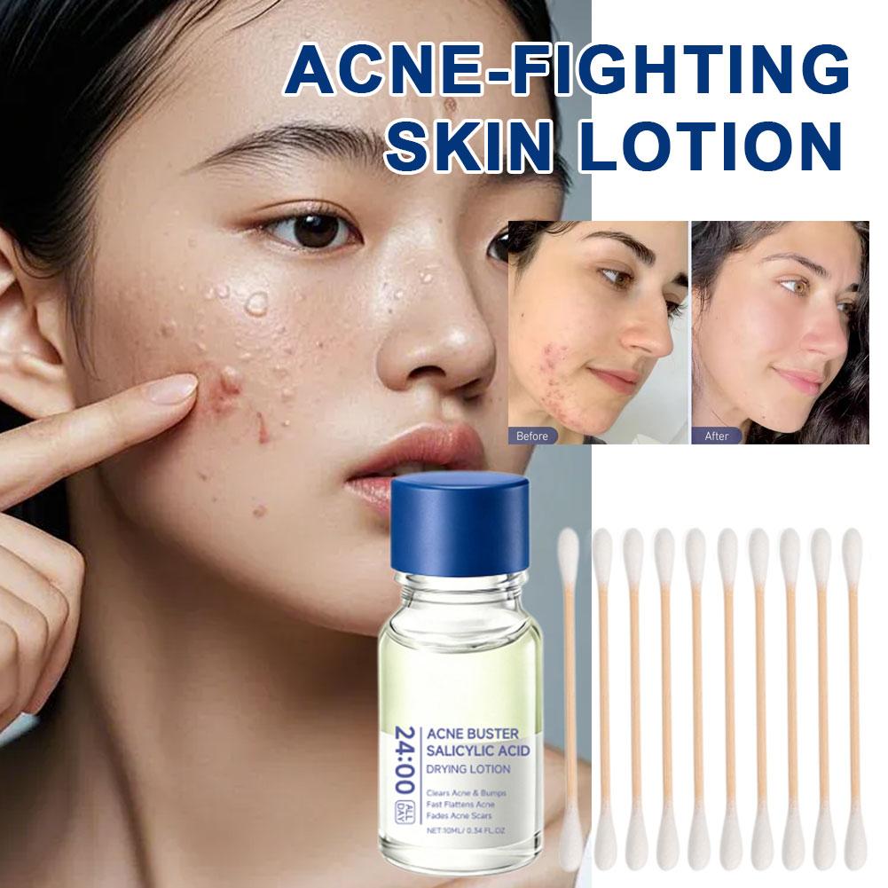 Loção de Tratamento com Ácido  - Skincare Salicylic Acid avaliação e preço