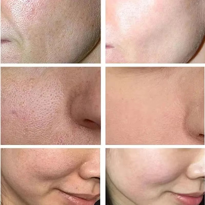Creme Redutor de Poros com Áci - Skincare Salicylic Acid avaliação e preço