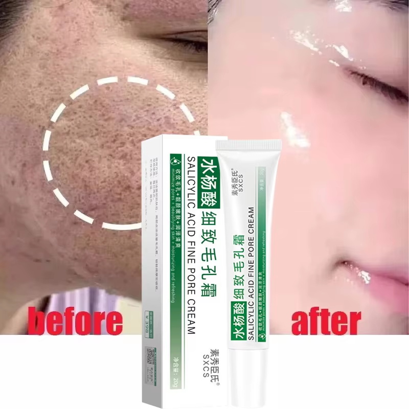 Creme Redutor de Poros com Áci - Skincare Salicylic Acid avaliação e preço