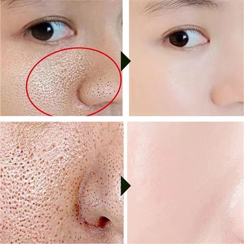 Creme Redutor de Poros com Áci - Skincare Salicylic Acid avaliação e preço